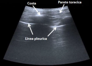 Ecografia Del Torace